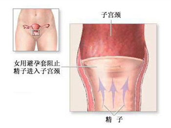 360度全方位目击女人避孕过程