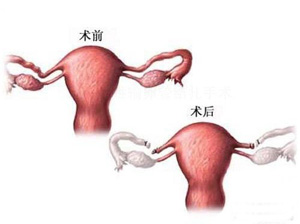 性爱