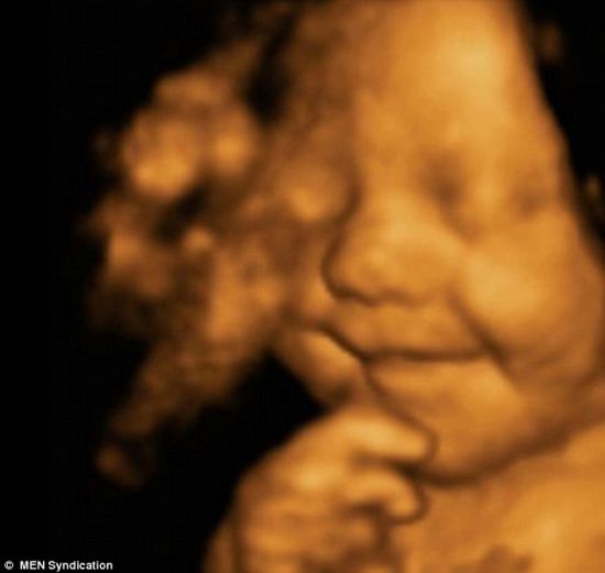 英国最幸福宝宝：从腹中胎儿到婴儿笑不停（图）