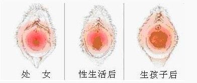 两性