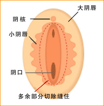 两性