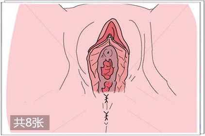 两性