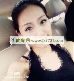 鼻子上的黑头注意清洁